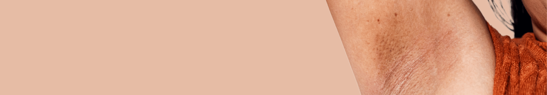 blanquemiento de axilas