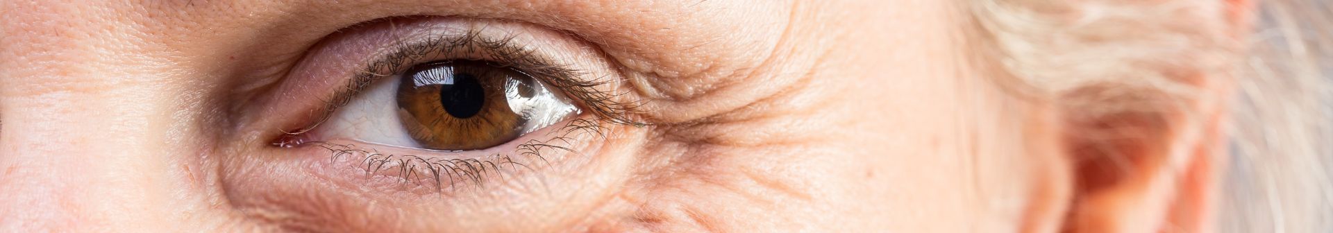 como quitar las lineas de expresion
