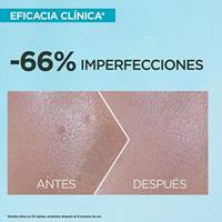 Bloqueador para tendencia al acné