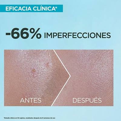 Bloqueador para tendencia al acné